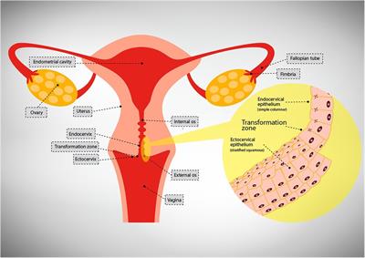 Role of the epithelium in human papillomavirus and human immunodeficiency virus infections in the female genital tract